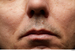 Man Face Skin Textures